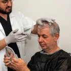 The Benefits of Choosing a Hair Transplant Clinic Abroad
